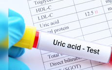 Người tăng axit uric cần tránh loại thực phẩm nào?