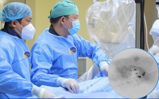 Người đàn ông 64 tuổi đang khỏe mạnh, bất ngờ đột quỵ từ dấu hiệu nhiều người Việt bỏ qua
