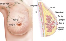 6 nhóm người có nguy cơ mắc ung thư vú cao, đây là 7 dấu hiệu cảnh báo bệnh, chị em cần cảnh giác