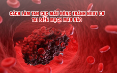 Cách hỗ trợ làm tan cục máu đông tránh nguy cơ tai biến mạch máu não