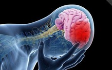 Đột quỵ: 'Sát thủ thầm lặng' khiến gần 50% người mắc không qua khỏi