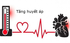 Đừng coi thường: 5 dấu hiệu tăng huyết áp ở người trẻ có thể dẫn tới đột quỵ sớm