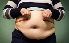 Nhồi máu có tim - người béo phì có dấu hiệu này cần cảnh giác