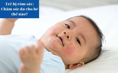 Trẻ bị rôm sảy: Chăm sóc da thế nào?