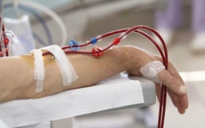 Người đàn ông 46 tuổi viêm tụy cấp, suy đa tạng nguy kịch: Bác sĩ chỉ cách phòng ngừa cực đơn giản
