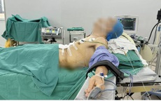 Ca mổ đặc biệt: Phẫu thuật ung thư dạ dày cho bệnh nhân gù vẹo cột sống, lưng gập gần 90 độ