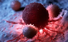 Loại quả mùa đông ăn sống hay nấu chín đều ngon, người Việt nên ăn để ngăn ngừa tế bào ung thư