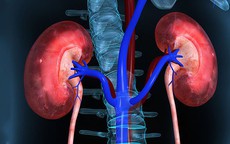 Thanh niên 26 tuổi suy thận phải chạy thận, không tin mình mắc bệnh vì vẫn thấy cơ thể bình thường