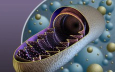 Người phụ nữ 45 tuổi bị 'đột quỵ giả’ do mắc bệnh di truyền ít gặp