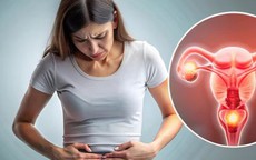 Đau bụng dưới cảnh giác với xoắn buồng trứng