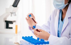 Xét nghiệm ADN khiến chồng nghi vợ ngoại tình, khoa học lại chứng minh người vợ vô tội