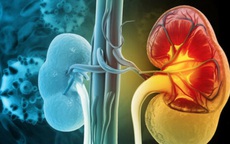 Người suy thận nên ăn hoa quả gì để tránh tăng kali, bảo vệ chức năng thận?