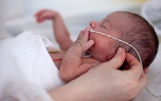 Trí tuệ nhân tạo dự đoán biến chứng sức khỏe ở trẻ sinh non