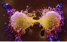 Món ăn thơm ngon khoái khẩu ngày lạnh nhưng tiềm ẩn tế bào ung thư, người Việt nên biết để tránh