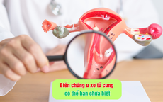 Biến chứng u xơ tử cung có thể bạn chưa biết