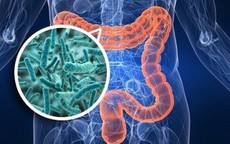 Không có triệu chứng tiêu hóa điển hình, nam kỹ sư bất ngờ phát hiện ung thư đại trực tràng từ dấu hiệu nhiều người Việt mắc phải