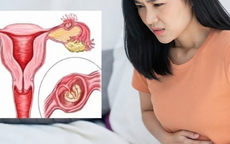 Dấu hiệu mang thai ngoài tử cung cần nhận biết sớm