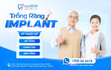 Quy trình cấy ghép Implant chuẩn y khoa: Nâng tầm trải nghiệm, an tâm phục hồi nụ cười