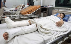 MS 1021: Mẹ làm phụ hồ nuôi 3 con, bất lực nhìn con trai 10 tuổi cần phẫu thuật sau tai nạn