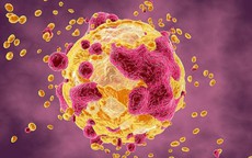 Loại cá 'nuôi lớn' tế bào ung thư, ngon đến mấy người Việt cũng không nên ăn nhiều