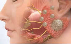 Người phụ nữ 38 tuổi âm thầm một mình chiến đấu với ung thư, thừa nhận 1 sai lầm nhiều người Việt mắc phải