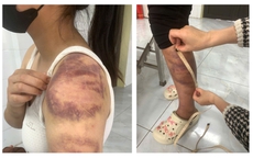 Bắc Ninh: Tạm giữ hình sự đối tượng 32 tuổi ngược đãi, hành hạ vợ con