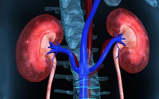 8 dấu hiệu bệnh suy thận, người Việt cần biết để phòng bệnh từ sớm
