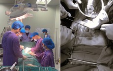 Người đàn ông 49 tuổi nguy kịch do ngã từ độ cao 4m khi dọn nhà đón Tết