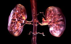 4 nguyên nhân làm tăng nguy cơ suy thận trong mùa lạnh, người Việt cần biết để tránh mắc bệnh