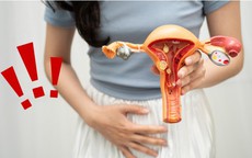 Cô gái 25 tuổi đang khỏe mạnh bất ngờ phát hiện ung thư cổ tử cung từ dấu hiệu nhiều chị em Việt bỏ qua