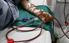 Loại thịt ăn nhiều có thể làm tăng tốc độ suy thận, người Việt cần hiểu đúng để phòng bệnh