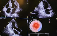 Phẫu thuật ghép tim và gan thành công cho bệnh nhân mắc bệnh hiếm