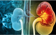 Thói quen ăn uống tăng nguy cơ suy thận, nhiều người Việt đang mắc phải mà không biết