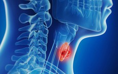 Bé 13 tuổi tình cờ phát hiện ung thư tuyến giáp di căn từ 1 dấu hiệu nhiều người Việt mắc phải