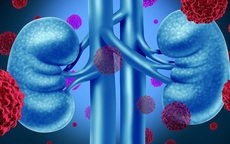 Người phụ nữ 67 tuổi bất ngờ phát hiện ung thư thận giai đoạn sớm từ 1 việc nhiều người Việt bỏ qua