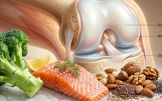 5 loại thực phẩm tốt nhất cho xương khớp khỏe mạnh