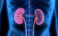 Nắng nóng, 6 việc người Việt nên làm để phòng ngừa nguy cơ suy thận và bệnh lý đường tiết niệu