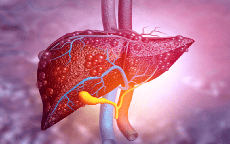 Người đàn ông 34 tuổi suy gan cấp vì sai lầm trong lúc giảm cân nhiều người Việt mắc phải