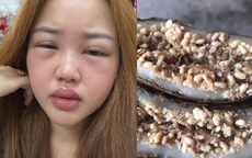 Thưởng thức bánh trứng kiến đang hot: Người khen ngon, người nhập viện vì sốc phản vệ