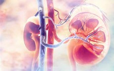 Người đàn ông 35 tuổi bị suy giảm chức năng thận vì bỏ qua 1 dấu hiệu nhiều người Việt mắc phải