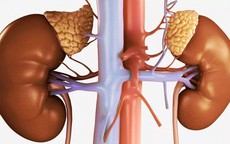 Người phụ nữ 39 tuổi bất ngờ phát hiện u tuyến thượng thận từ dấu hiệu nhiều người Việt bỏ qua