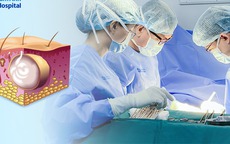 U bã đậu 10 năm bất ngờ hóa ung thư ở người đàn ông 40 tuổi, dấu hiệu cảnh báo nhiều người bỏ qua