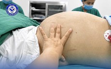 Thiếu nữ 19 tuổi mang khối u buồng trứng khoảng 30cm vì tâm lý chủ quan phụ nữ Việt hay mắc phải
