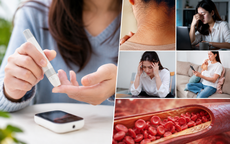 Loại bệnh đang âm thầm gia tăng: Bác sĩ chỉ ra 6 dấu hiệu cảnh báo tiền tiểu đường nhiều người bỏ qua