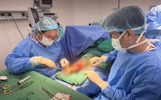 Suýt mất cả chân sau tai nạn giao thông, cô gái 21 tuổi được cứu bằng kỹ thuật lấy da từ da đầu