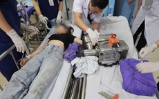 Cô gái 19 tuổi nguy cơ mất bàn tay vĩnh viễn vì sơ suất trong lúc dùng máy xay