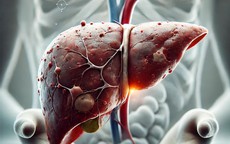 Ngứa mãi không hết, bác sĩ cảnh báo đừng chỉ nghĩ do dị ứng: Có thể gan đang gặp vấn đề