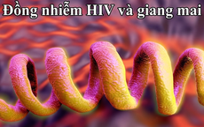 Đồng nhiễm HIV và giang mai: Tầm soát định kỳ để ngăn chặn biến chứng tổn thương thần kinh