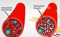 Người đàn ông 30 tuổi tử vong tại bàn làm việc, đường huyết tăng vọt vì bệnh tiểu đường: Bất ngờ từ chế độ ăn