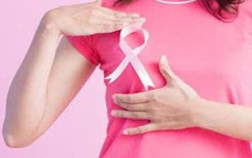 Khi nào cần làm xét nghiệm gene ung thư vú?
